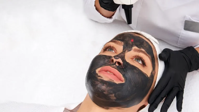 Carbon Laser Peel at Afsoon Beauty Lounge, Richmond Hill