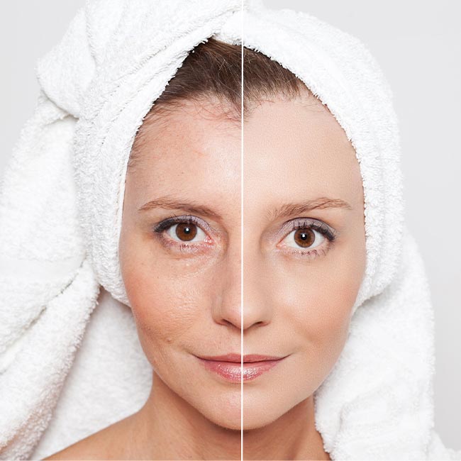 Scar & Skin Camouflage at Afsoon Beauty Lounge, Richmond Hill (3)