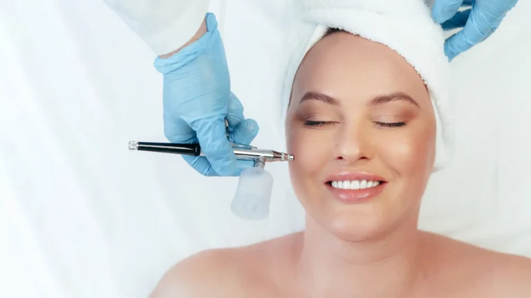 Microneedling at Afsoon Beauty Lounge, Richmond Hill
